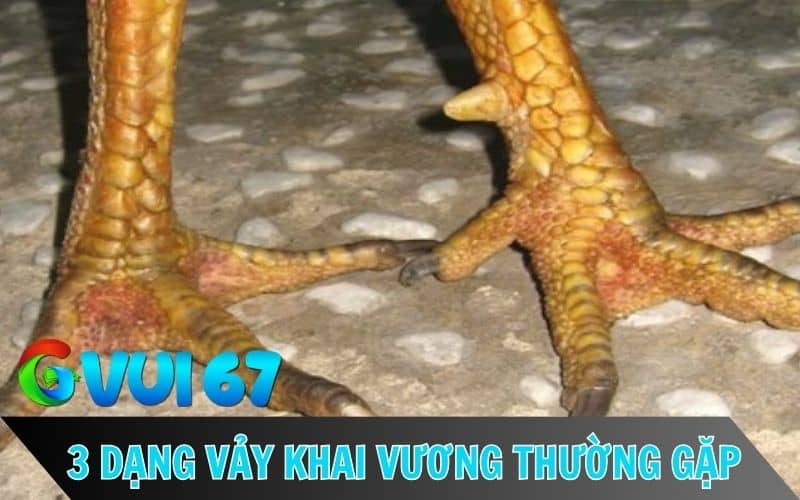 Vảy khai vương có 3 dạng chính thường xuất hiện